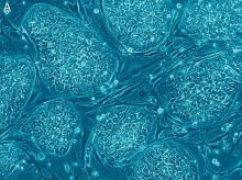 Körtner spricht sich für eine Förderung und gleichzeitige Regulierung der Forschung an menschlichen Stammzellen (im Bild) aus. Foto: wikimedia/Nissim Benvenisty