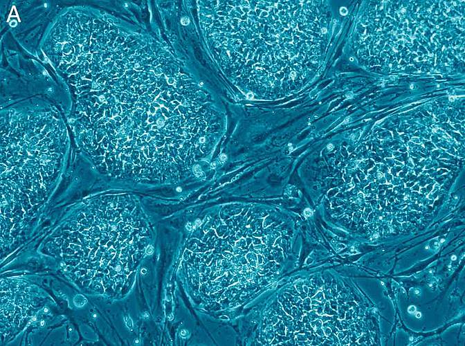 Körtner spricht sich für eine Förderung und gleichzeitige Regulierung der Forschung an menschlichen Stammzellen (im Bild) aus. Foto: wikimedia/Nissim Benvenisty